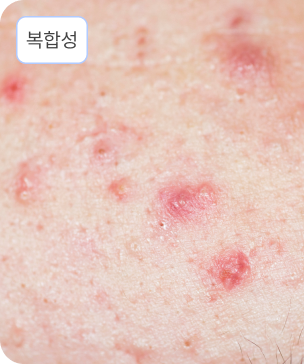 복합성