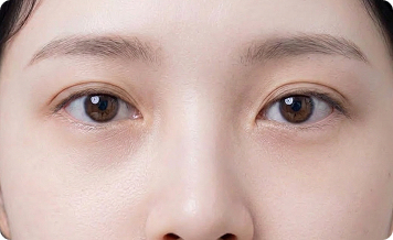 색소