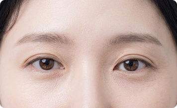 주름