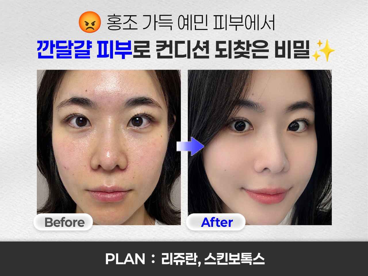 테스트이미지입니다.