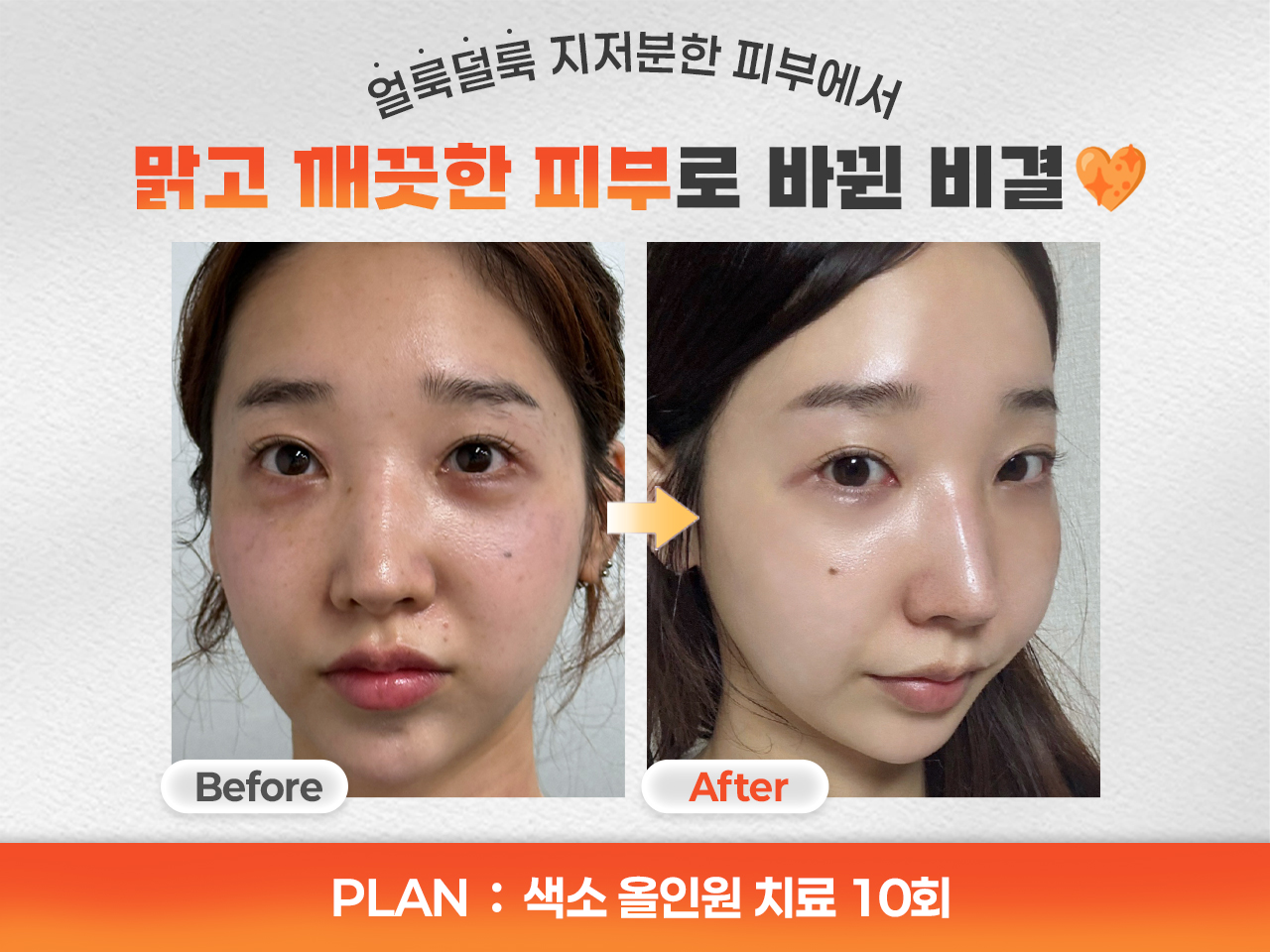 테스트이미지입니다.