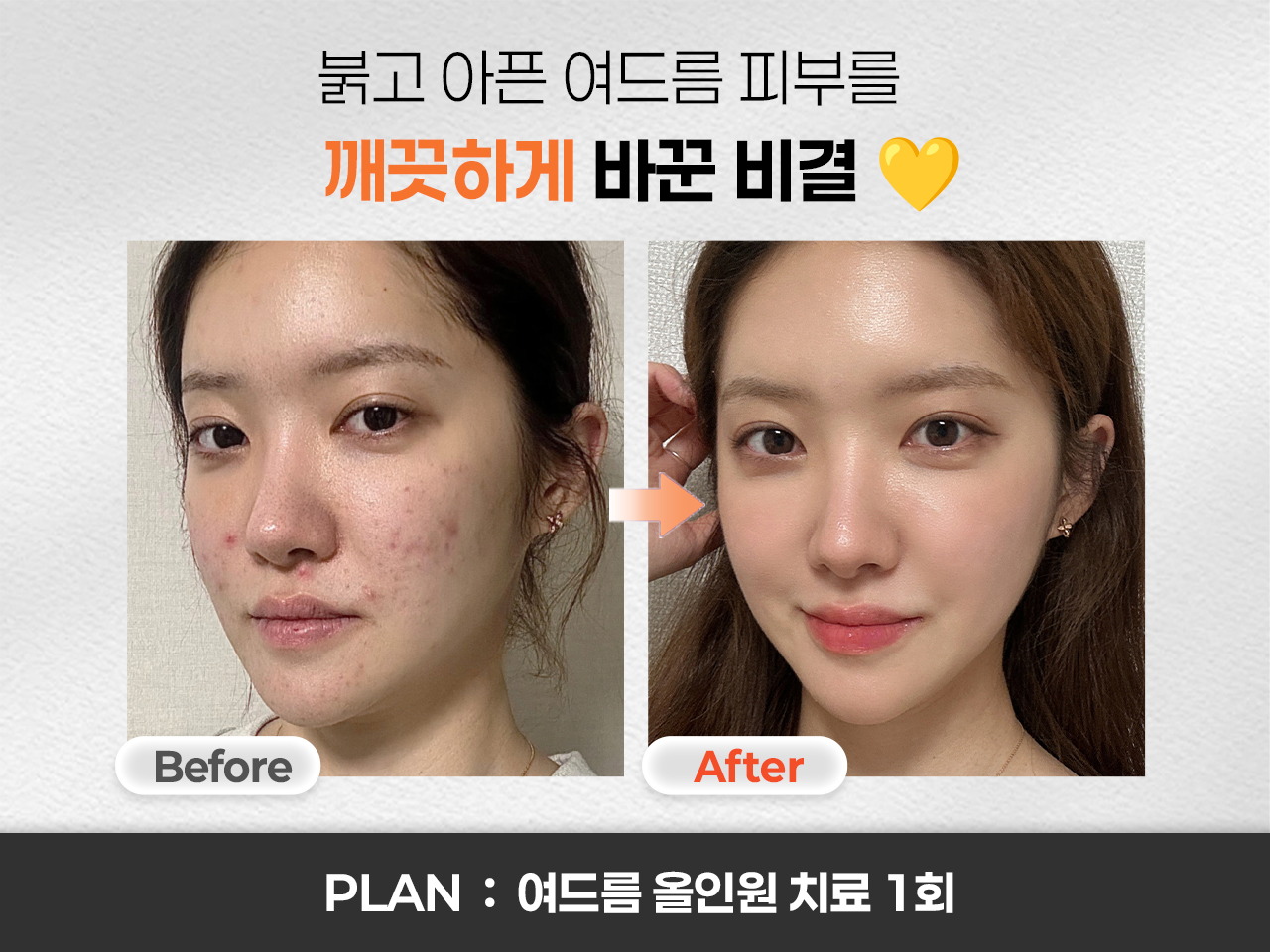 테스트이미지입니다.